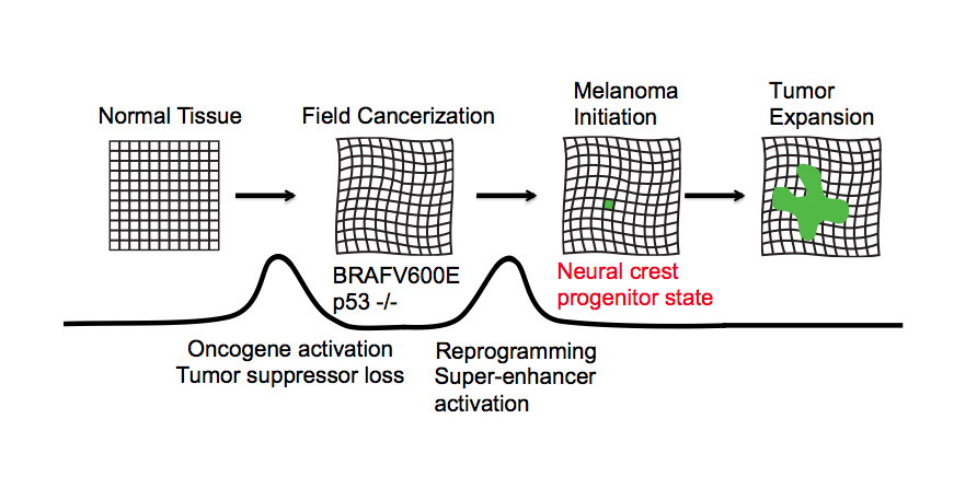 The Cell that Caused Melanoma: Cancer's Surprise Origins, Caught in