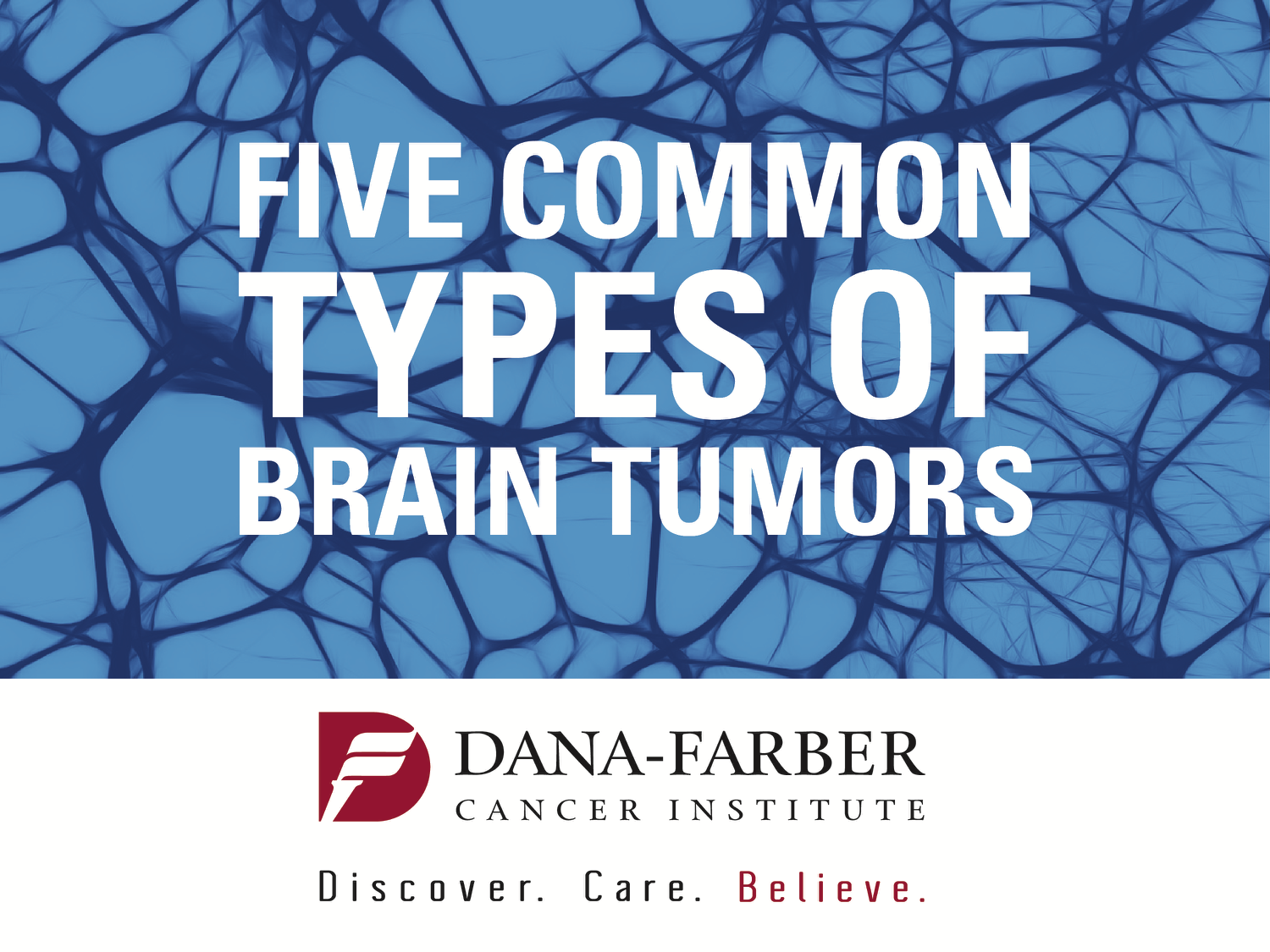 Five common types of brain tumors: glioblastoma, lower-grade gliomas, primary CNS (central nervous system) lymphoma, brain metastases (secondary brain tumors), meningiomas.
