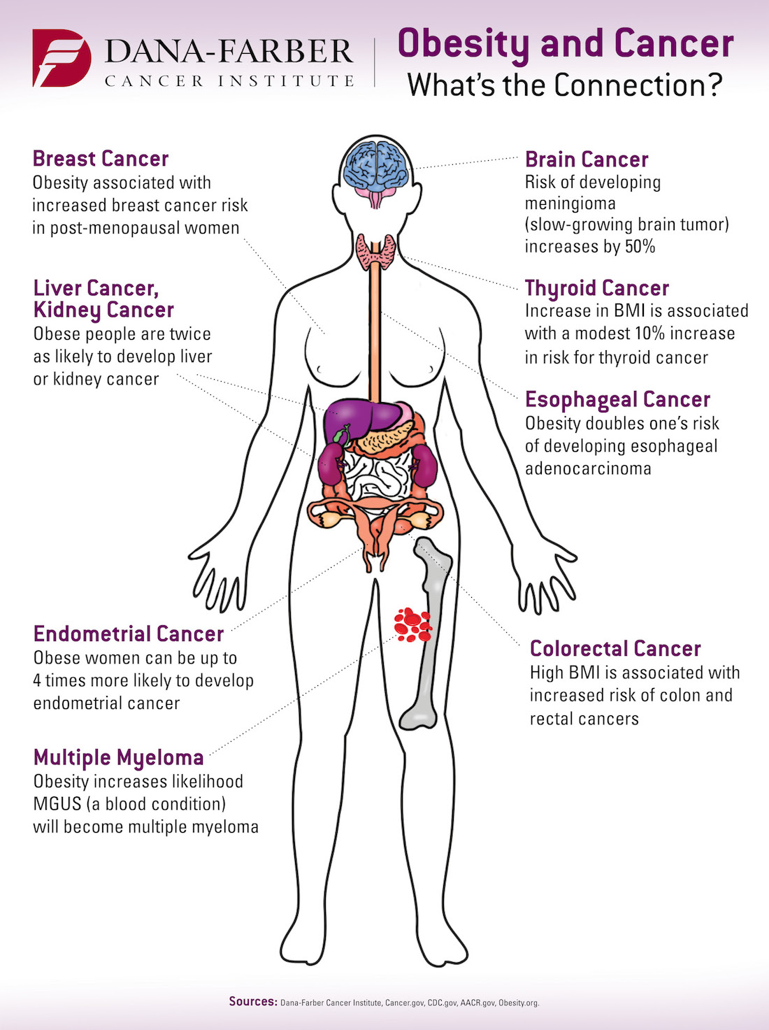 obesity and cancer infographic