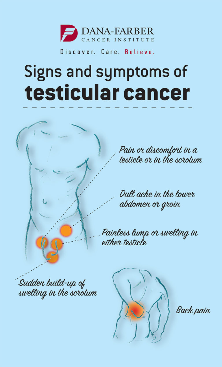 Treatment Of Testicular Cancer In Young Men Dana Farber Cancer Institute 6533