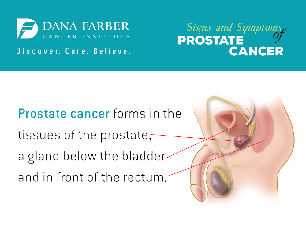 What is the symptoms of prostate