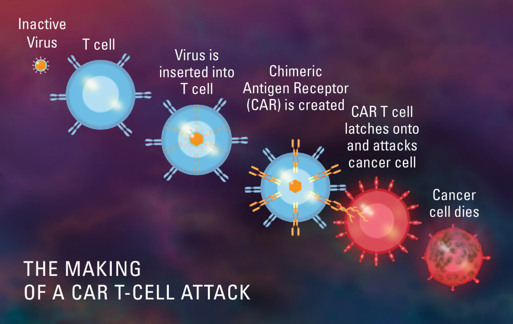 An image describing the making of a CAR T-cell attack. CAR T-cell therapy is a type of treatment in which a patient's T cells (a type of immune system cell) are changed in the laboratory so they will attack cancer cells.