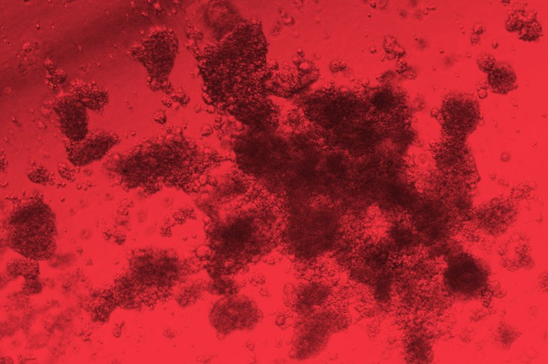 Red blood cells produced by a single progenitor cell (IMAGE COURTESY HOJUN LI / DANA-FARBER/BOSTON CHILDREN’S VIA CELL PRESS)