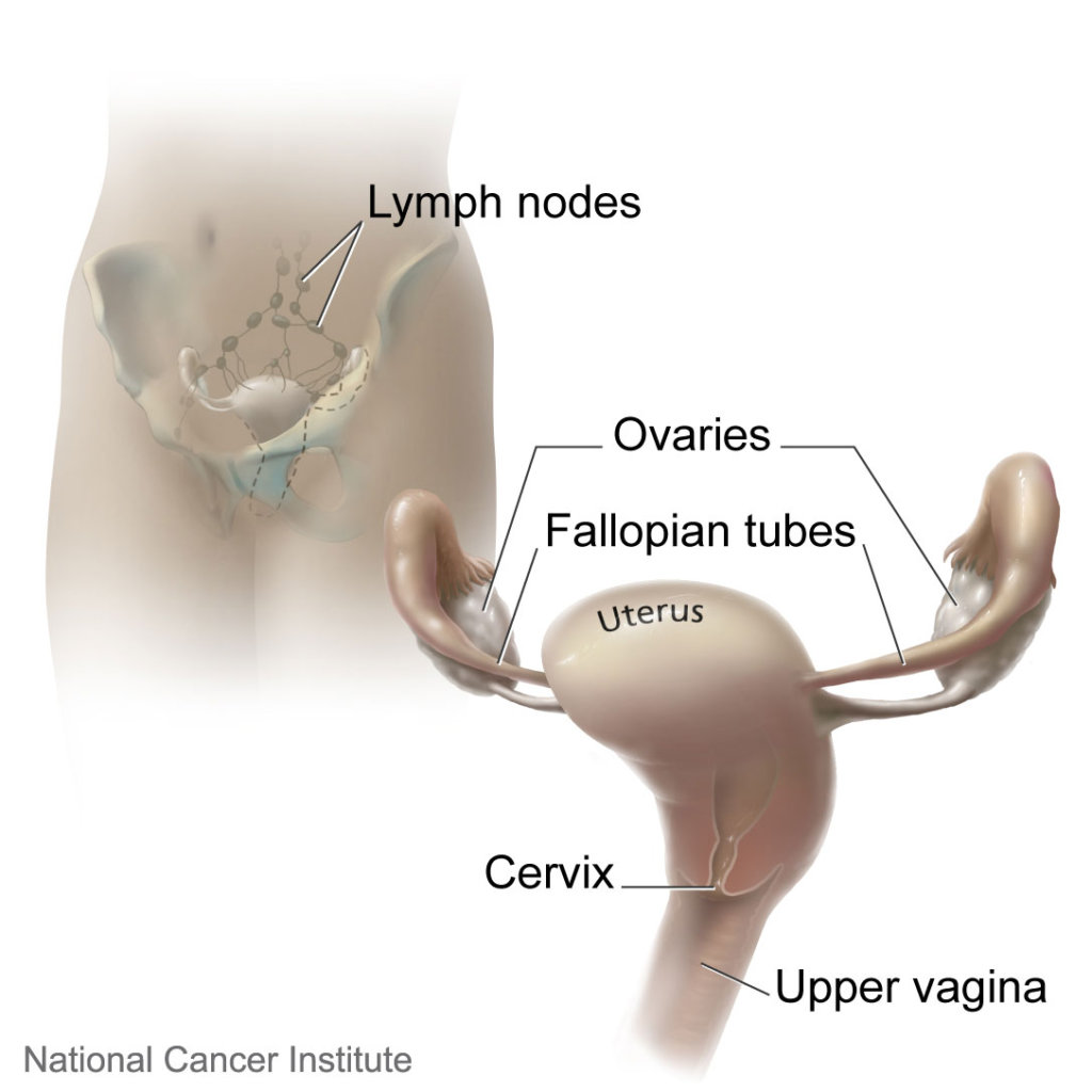 The location of the cervix and nearby organs and lymph nodes, as well as a close-up view of the ovaries, fallopian tubes, uterus, cervix, and upper vagina. Photo credit: National Cancer Institute.