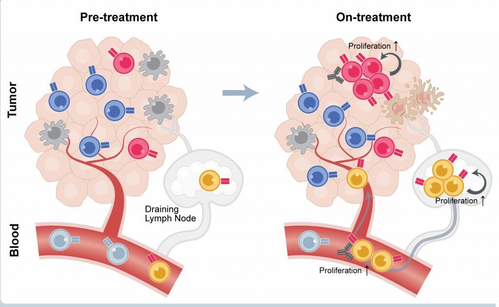 In a recent study involving patients with cancers of the oral cavity, Dana-Farber researchers found that in response to treatment with checkpoint inhibitor drugs, certain sets of T cells within tumors and the bloodstream multiply rapidly to attack the cancer.