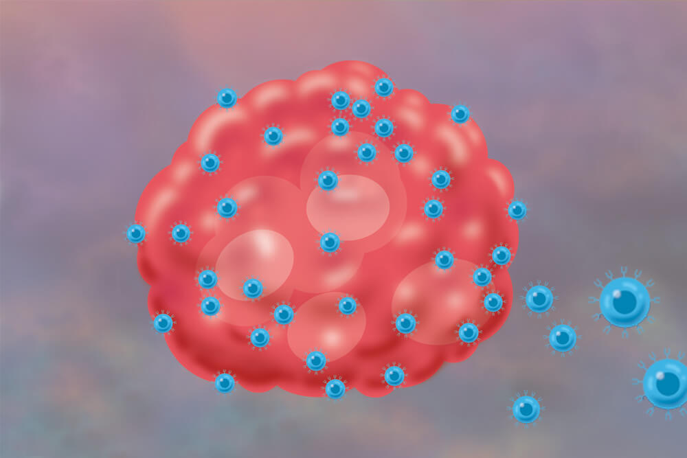 An illustration of T cells infiltrating a tumor.