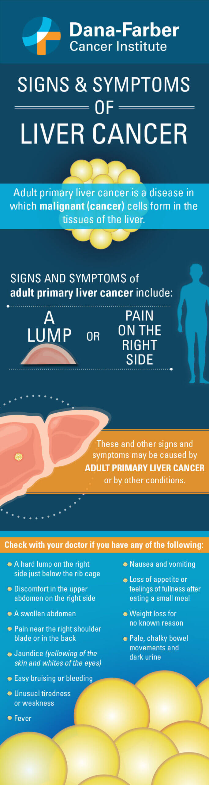 Signs And Symptoms Of Liver Cancer Infographic Dana Farber Cancer Institute 0980