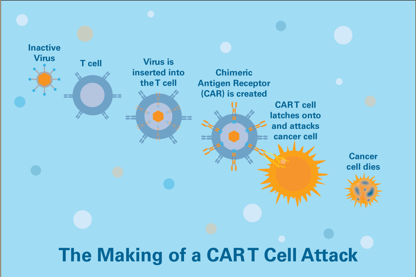An illustration of the CAR T-cell therapy process. CAR T cells are made by removing some of the patient’s own immune cells and equipping them with an individualized laboratory-made receptor.
