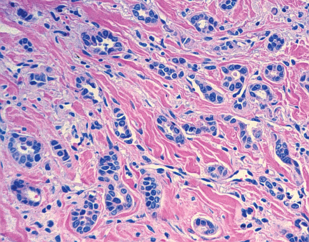An image of cells. Pathology reports will include details that can help guide treatment options.