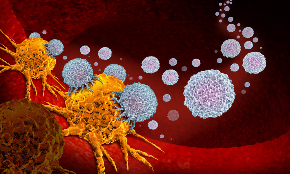 Cancer vaccines, including those for prostate cancer, work by stimulating immune system cells (shown in blue) to attack cancer cells in the body.