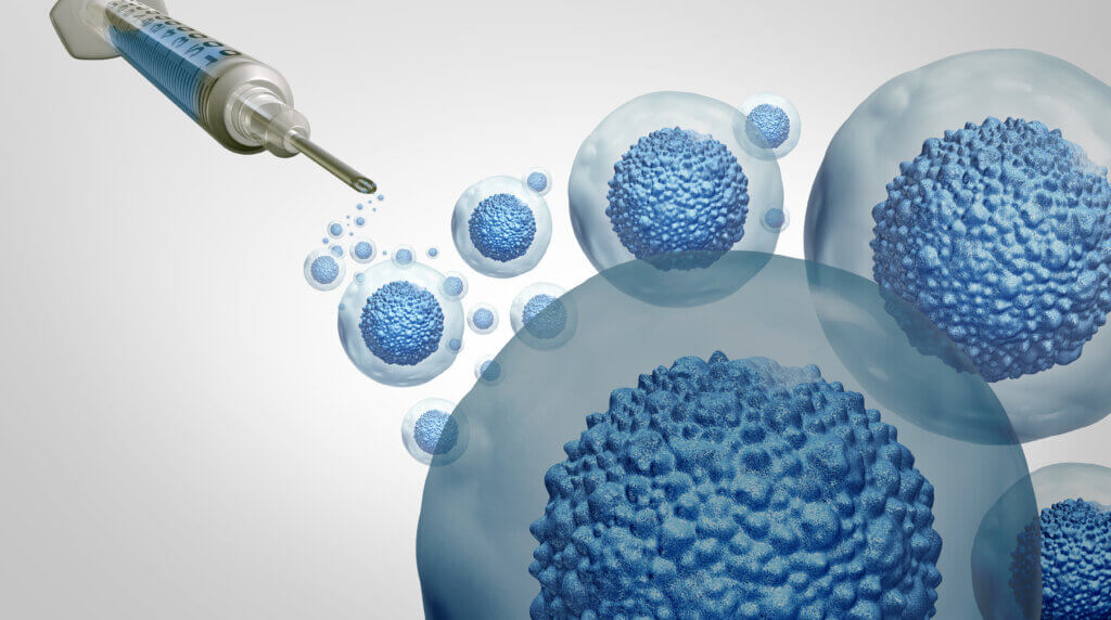 Stem cell transplant illustration 